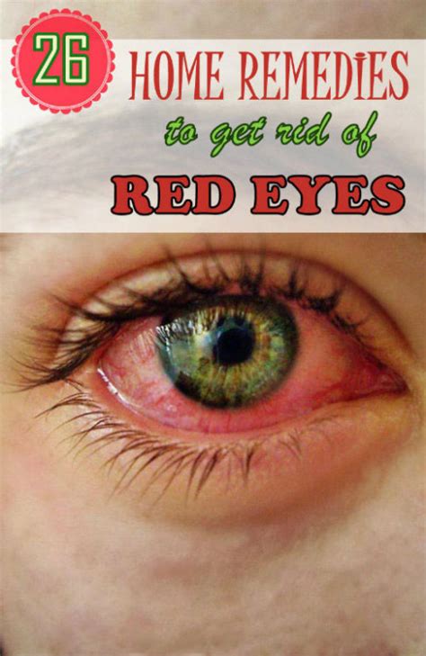 Home Remedy Hacks • 26 Effective Home Remedies to Get Rid of Red Eyes