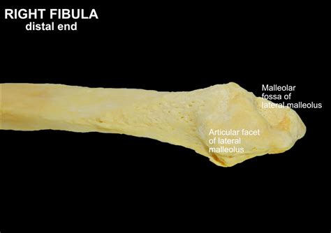 FIBULA – Clinical Anatomy