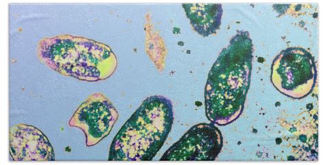 Rickettsia Prowazekii Under A Microscope