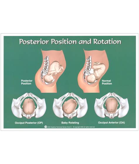 Posterior Baby