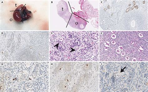 Histology and immunohistochemistry of ovotestis; histologically ...