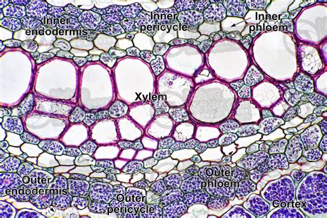 Dennstaedtia sp. Rhizome. Amphiphloic siphonostele. Transverse section. 500X - Dennstaedtia sp ...