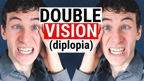 What Causes DOUBLE VISION (Diplopia) | 5 Common Causes for Diplopia ...