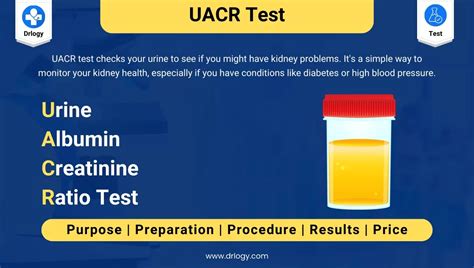 Urine Albumin Creatinine Ratio (uACR) Test: Price & Results - Drlogy