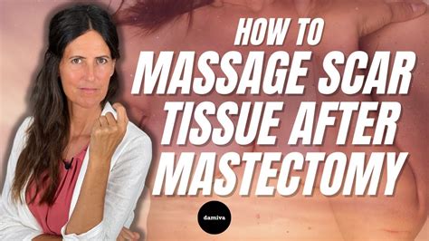 HOW To MASSAGE Your SCAR TISSUE After MASTECTOMY - YouTube