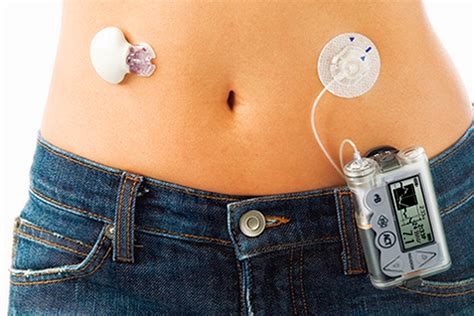 SugarDoctor - Insulin Pump Therapy Programme