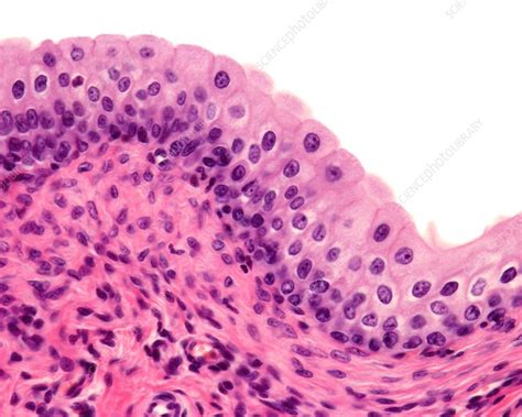 Transitional Epithelium Tissue