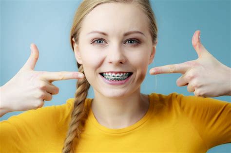 Blue Braces: How To Pick the Right Colors for Your Braces - Blue Ridge Orthodontics