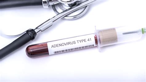 Adenovirus Infection: Symptoms, Causes, And Treatment | OnlyMyHealth