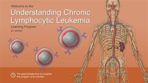 Understanding Chronic Lymphocytic Leukemia-A.D.A.M. OnDemand