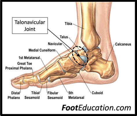 Talonavicular Arthritis - FootEducation