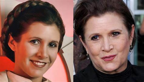 Carrie Fisher Facelift Plastic Surgery Before and After | Celebie