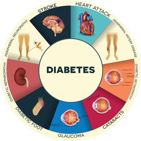 310+ Diabetes Complications Stock Illustrations, Royalty-Free Vector ...