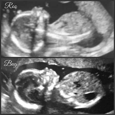 19 weeks - Ultrasound & Gender Reveal TOMORROW!!