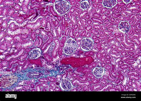 Bowmans Capsule Histology