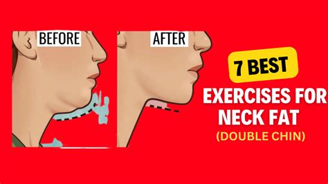 7 Best Exercises for Neck Fat