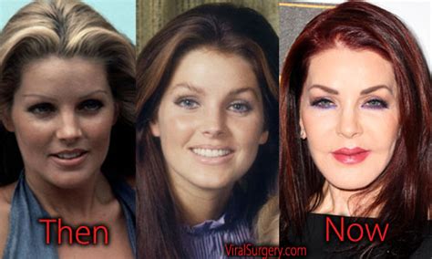 Priscilla Presley Plastic Surgery, Before and After Facelift Pictures