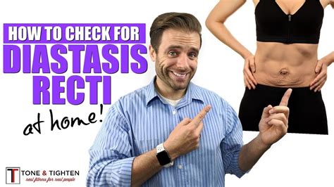 How To Check For Diastasis Recti - YouTube