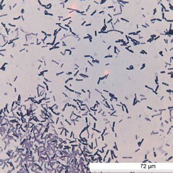 a. Spores and bacteria of Clostridium tetani with a typical drum-stick ...