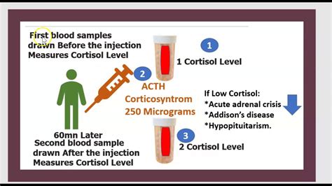 ACTH Stimulation Test Adrenocorticotropic hormone Cosyntropin blood ...