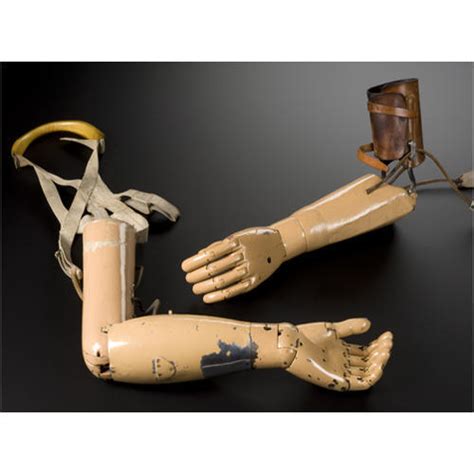 Upper Limb Prosthesis at Rs 25,000 / Piece in Secunderabad | Creative Orthotic & Prosthetic ...