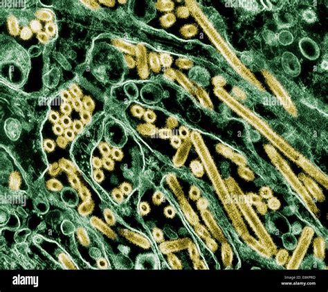 Colorized transmission electron micrograph of Avian influenza H5N1 ...