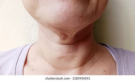 Woman Has Wrinkles On Her Neck Stock Photo 2185934591 | Shutterstock