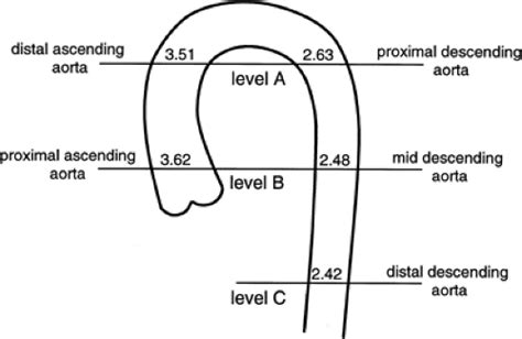 Aorta, Arch Vessels, and Great Veins | Thoracic Key