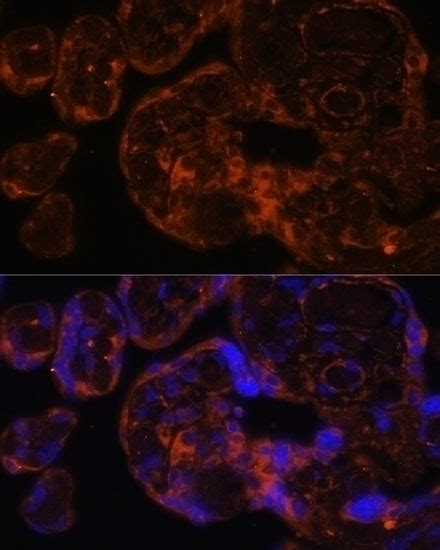 Factor IX / F9 Antibody - Cat. No. 16-228 | ProSci