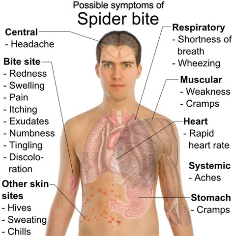 heidi montag fashion: spider bites symptoms in children