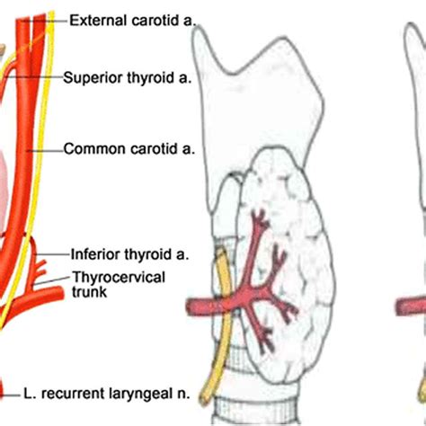 Normal right recurrent laryngeal nerve (A) and right nonrecurrent ...