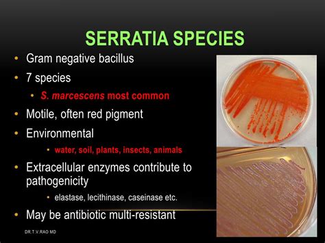 PPT - Serratia marcescens an emerging pathogen PowerPoint Presentation - ID:1904234