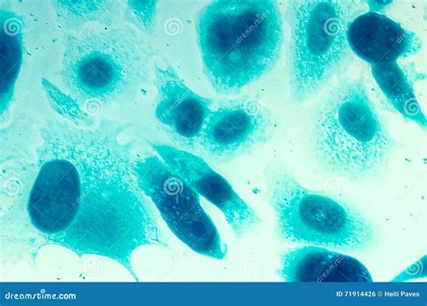 PC-3 Human Prostate Cancer Cells Stock Photo - Image of animal, cancer ...