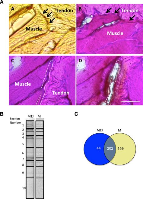 Proteomic analysis of laser capture microdissection of myotendinous... | Download Scientific Diagram