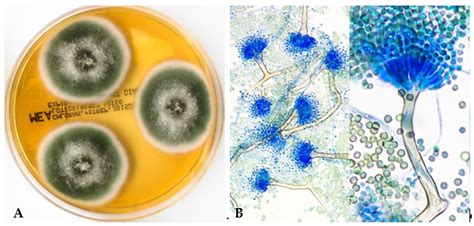 Diagnosis and Treatment of Invasive Aspergillosis Caused by Non ...