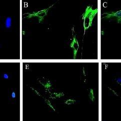 Human cultured RPE cells grew as a monolayer of cuboidal epithelial... | Download Scientific Diagram