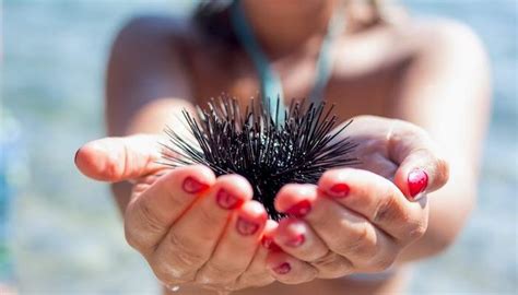 Steps to Properly Remove Sea Urchin Spikes — Healthy Builderz