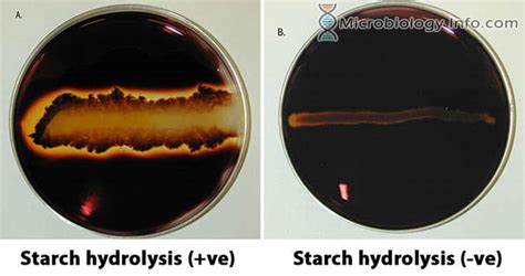 Starch Hydrolysis Test - Principle, Procedure, Uses and Interpretation