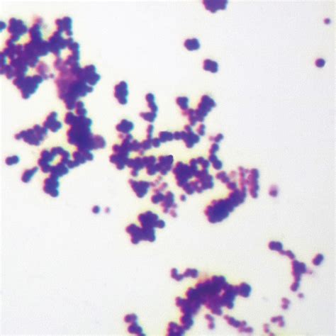 Mixed Gram-Positive & Gram-Negative Coccus, w.m. Gram Stain Microscope Slide | Carolina.com