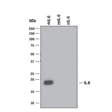 IL-6 Antibody (6708) [Unconjugated] (MAB206): Novus Biologicals