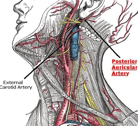 Carotid Artery: External Carotid Artery Supplies Blood To