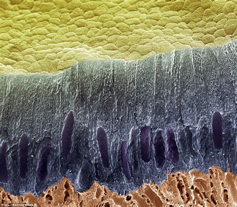 Scanning electron microscope (SEM) images show extreme close ups of plaque, incisors and decay ...