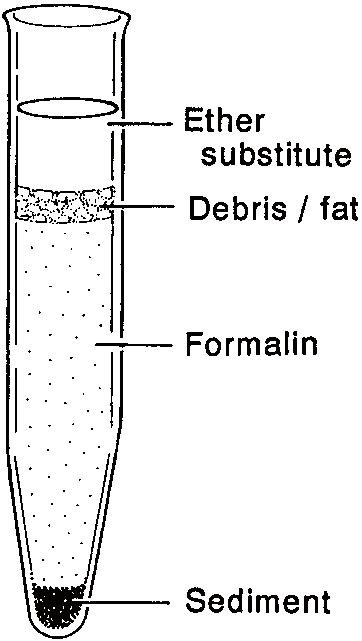 2. Diagram of specimen after centrifugation (sedimentation procedure). | Download Scientific Diagram