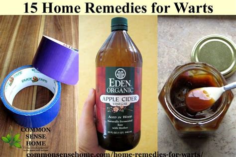 15 Home Remedies for Warts - Easy Home Wart Treatments