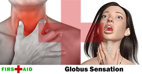 Globus Sensation – First Aid for Wellness: Ayurvedic, Folk Remedies & More