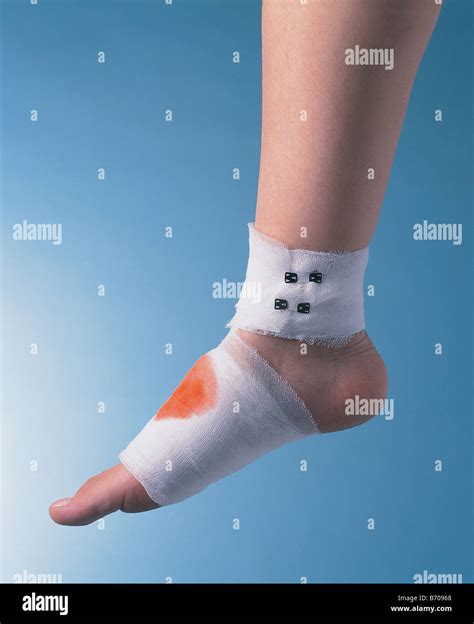 foot in bandage Stock Photo - Alamy