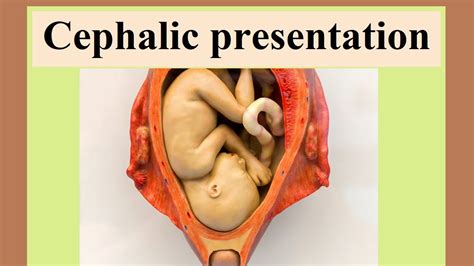 cephalic presentation - YouTube