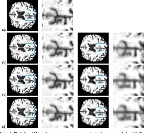Figure 3 From Brain Mri Super Resolution Using 3d Dil - vrogue.co