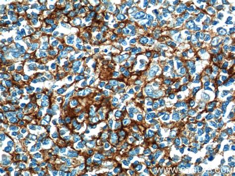 CD23 Antibody (18642-1-AP)