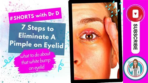 7 Steps to eliminate that bump on eyelid | Pimple on Eye? What to do ...